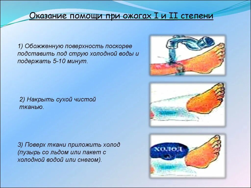 Ожоги обж 8 класс. Оказание первой доврачебной помощи при ожогах 1.2 степени. Оказание первой помощи при ожогах 1 и 2 степени. Оказание первой помощи при ожоге 1 степени. Оказание первой помощи при ожогах 2 и 3 степени.