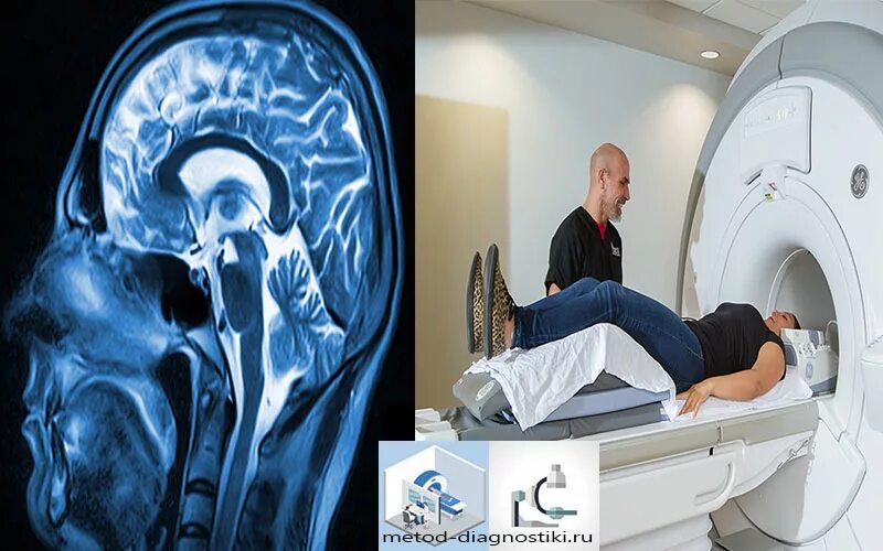 Можно ли кт. Магнито-резонансная томография головного мозга. Мрт сканирование. Обследование головного мозга томография. Процесс мрт головного мозга.