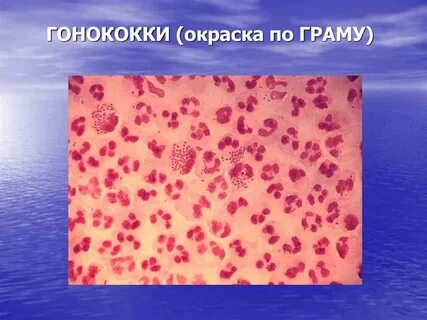 Гонококки это
