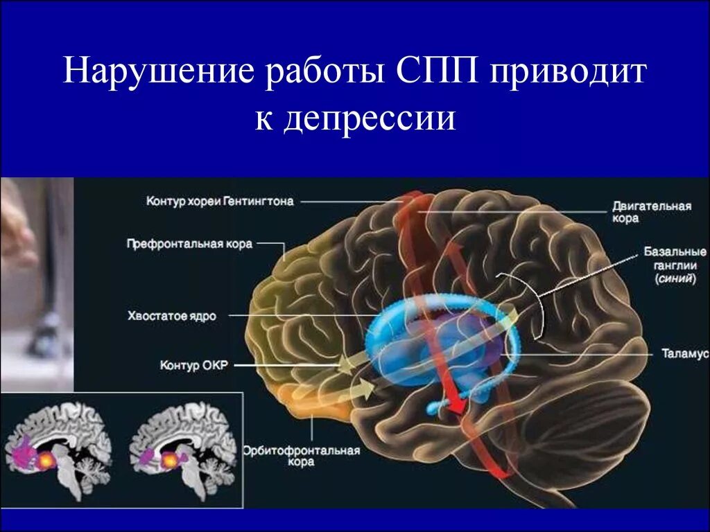 В мозгу есть область. Окр мозг. Активность мозга при окр. Мозг при окр.