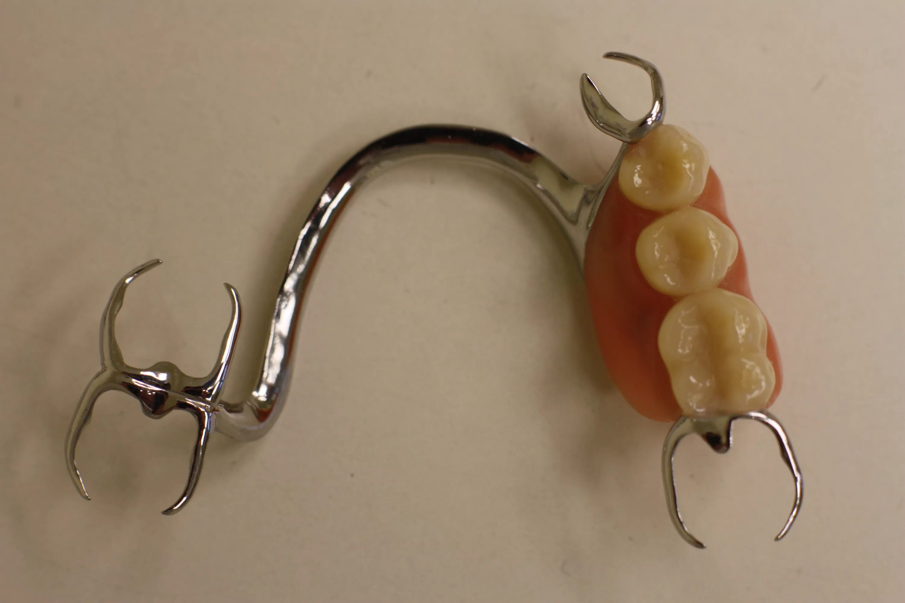 001. бюгельные протезы с кламмерным креплением. кламмерная система фиксации протезов. литье бюгельного протеза. кламмерная система фиксации протезов.