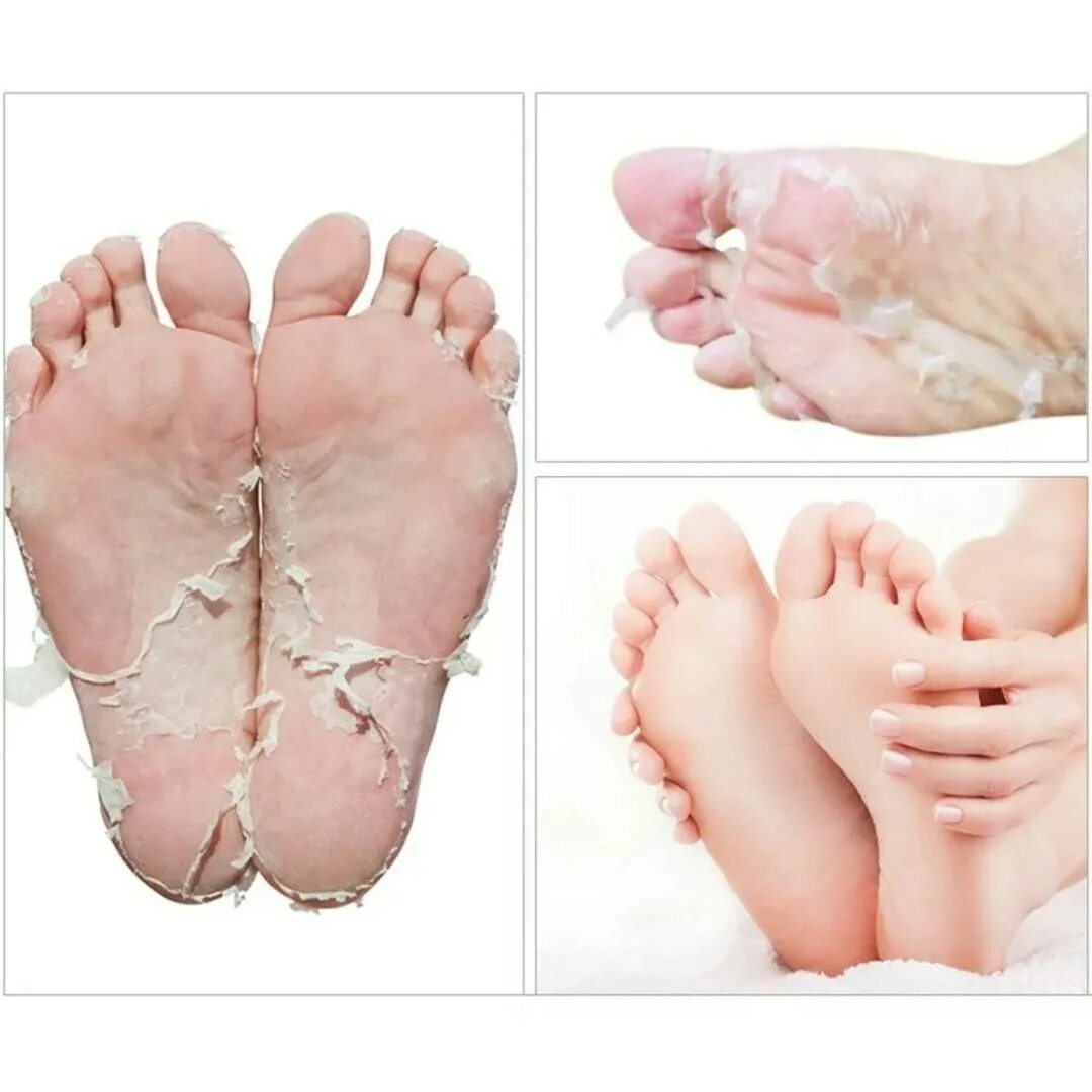 Отшелушивая маска носки для ног. Calmia Silky foot peeling пилинг носочки для ног. Exfoliating foot Mask маска носки для ног. Носочки для педикюра отшелушивающие Baby foot.
