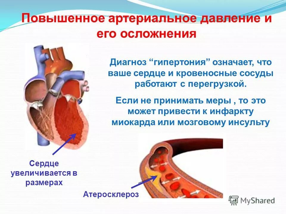 Повышение ад диагноз. Артериальная гипертензия. Артериальная гипертензия сердце. Сосуды при артериальной гипертензии. Сердце при артериальной гипертонии.