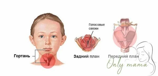 Почему у ребенка осипший голос. Гипертонусная дисфония. мутационная дисфония. афония голоса. афония у взрослых.