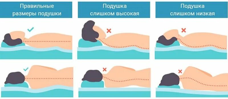 Правильная подушка для сна при шейном остеохондрозе. Правильное положение головы во время сна при шейном остеохондрозе. Правельное положения головы на подушке. Правильное положение головы во сне. Остеохондроз спать без подушки