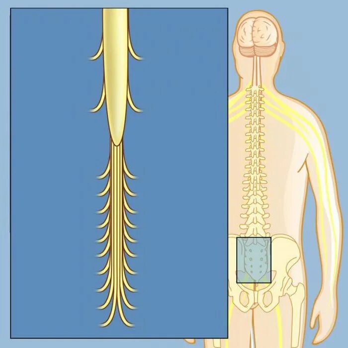Корешки поясницы. Конский хвост спинного мозга. Конский хвост спинного мозга анатомия. Липома Корешков конского хвоста.