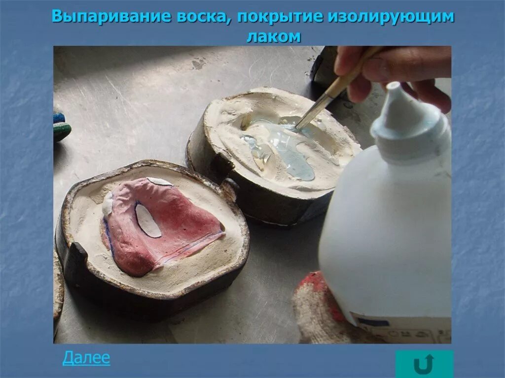 Полимеризация съемных протезов