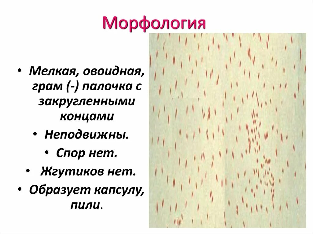 Бузинная палочка дамблдора. Палочка наземникуса флетчера. Смешанная мелкая палочка. Окраска по козловскому микробиология. Смешанная мелкая палочка.