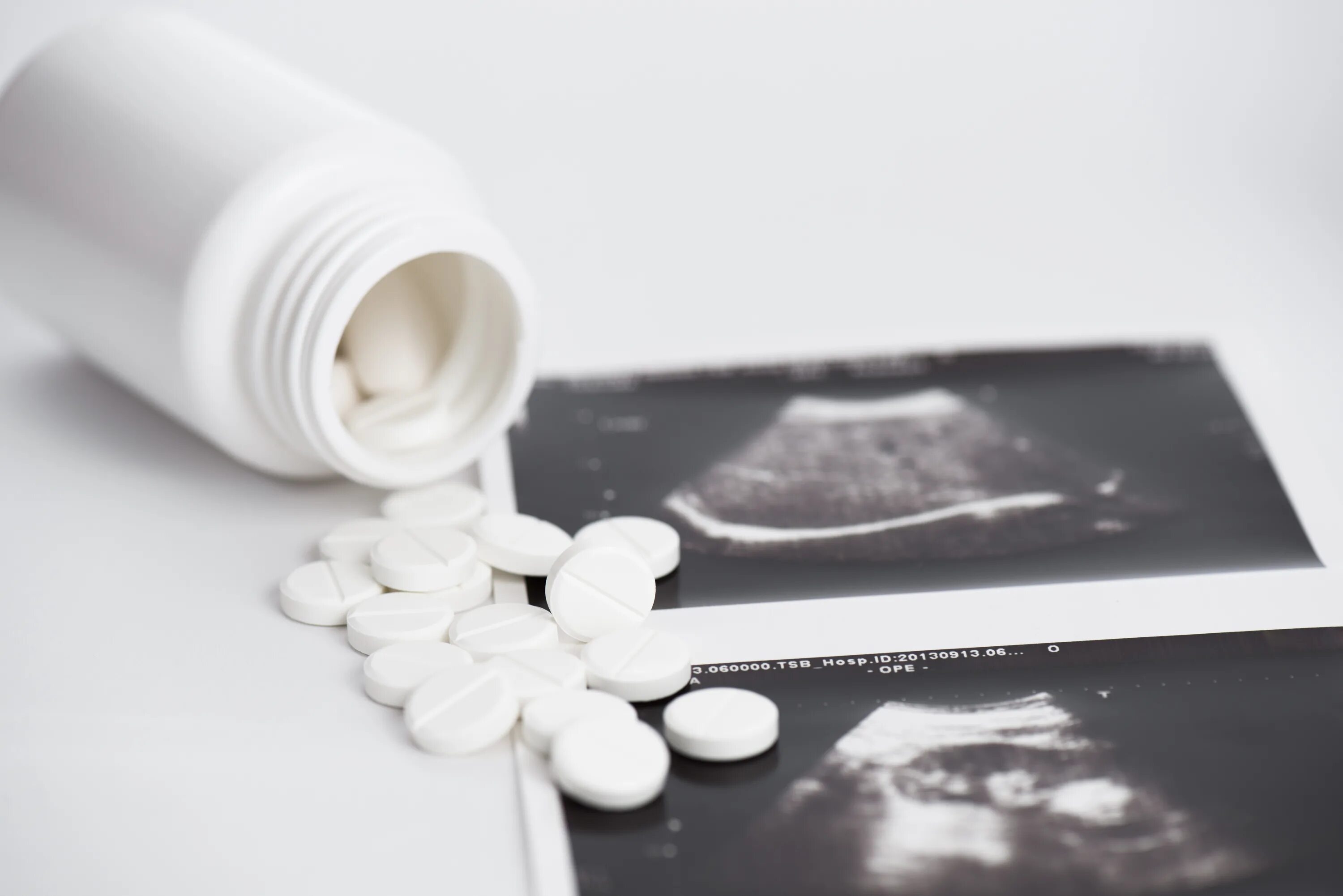 Медикаментозный аборт таблетки. Медикаментозное прерывание беременности картинки. Фармаборт таблетки. Таблетки для искусственного аборта.