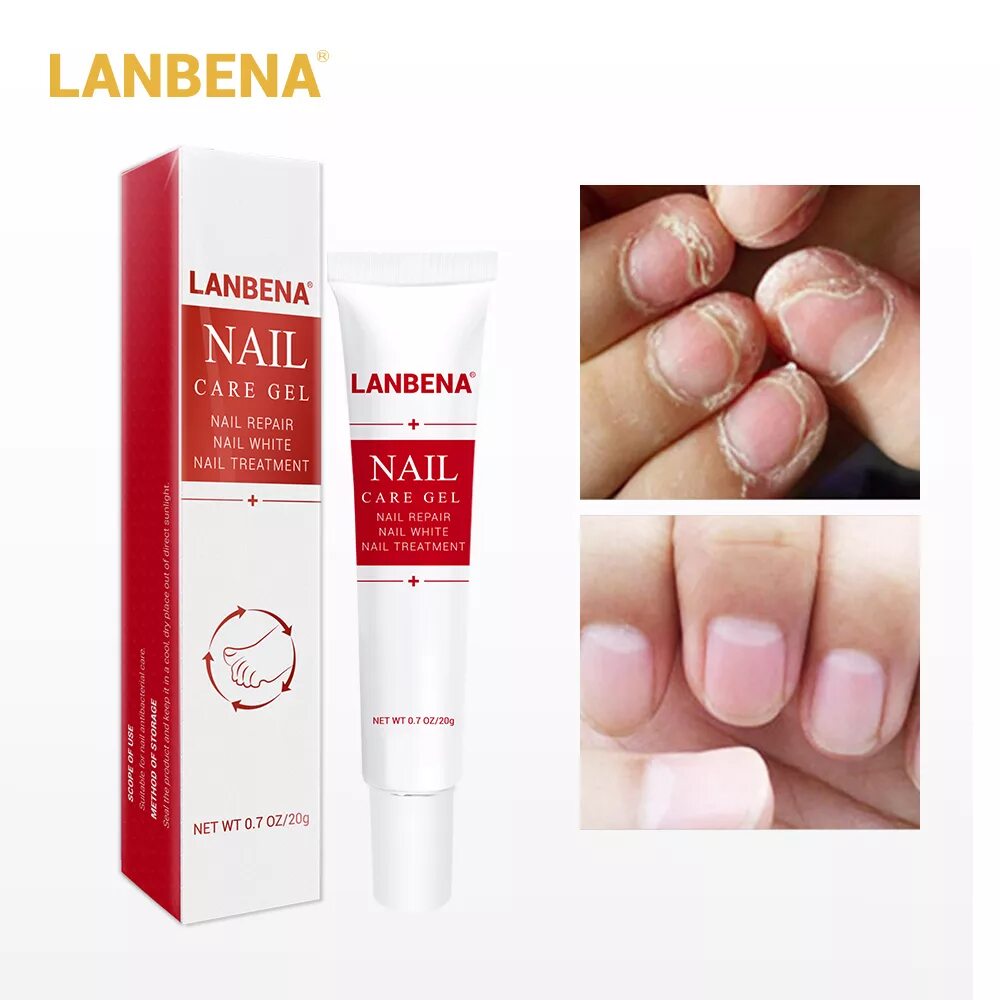 Гель от грибка ногтей отзывы. LANBENA Nail Repair Essence от грибка ногтей. Ланбена Care Gel. Ланбена для ногтей Nail Care Gel. Наил Репаир гель.