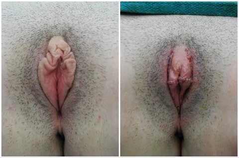 Nude arousal