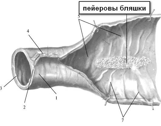 Пейеровы бляшки функции. Пейеровы бляшки в кишечнике. Строение пейеровой бляшки иммунология. Пейеровы бляшки анатомия. Пейеровы бляшки расположены в слизистой оболочке.
