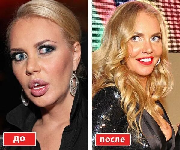 Маша малиновская неудачная пластика. Малиновская до операции. Маша малиновская до пластики. Маша малиновская до и после. Малиновская маша до и после пластики.