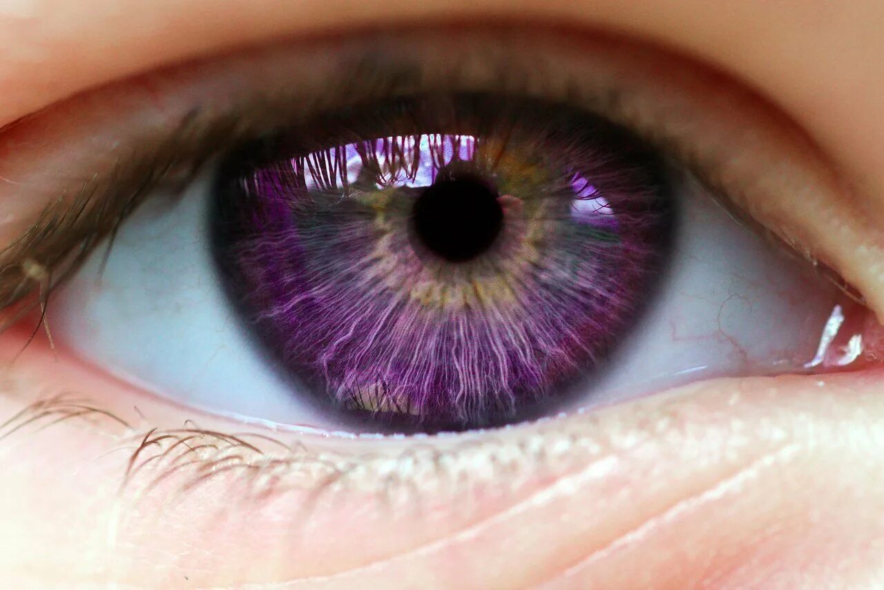 Почему глаза розовые. Центральная гетерохромия хамелеон. Гетерохромия Радужки глаз. Центральная гетерохромия карих глаз. Фиолетовая гетерохромия.