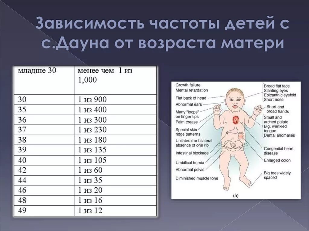 Вероятность синдрома Дауна по возрасту. Статистика синдрома Дауна по возрасту. Зависимость синдрома Дауна от возраста матери. Статистика рождения детей с синдромом Дауна. Процент даунов