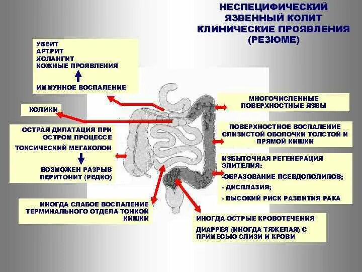 Кишечник артрит. Хронический неспецифический язвенный колит этиология. Неспецифический язвенный колит клинические рекомендации 2022. Язвенный колит клинические рекомендации 2022. Клинические проявления няк.