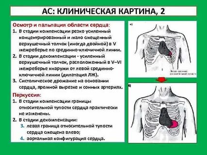 Осмотр перкуссии