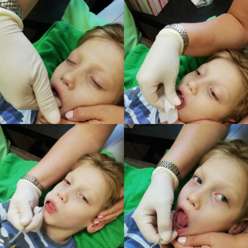 логопедический массаж обучение очно