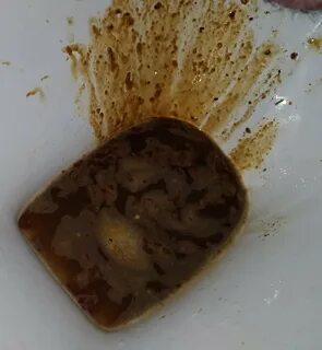 Что делать когда рвешь желчью и понос - фото презентация 