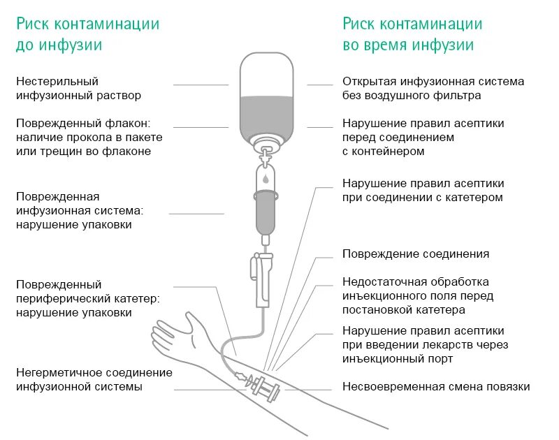 Строение системы для внутривенного капельного вливания. Устройство системы для внутривенного капельного вливания схема. Строение капельницы. Инфузионная система составные части. Как пользоваться system