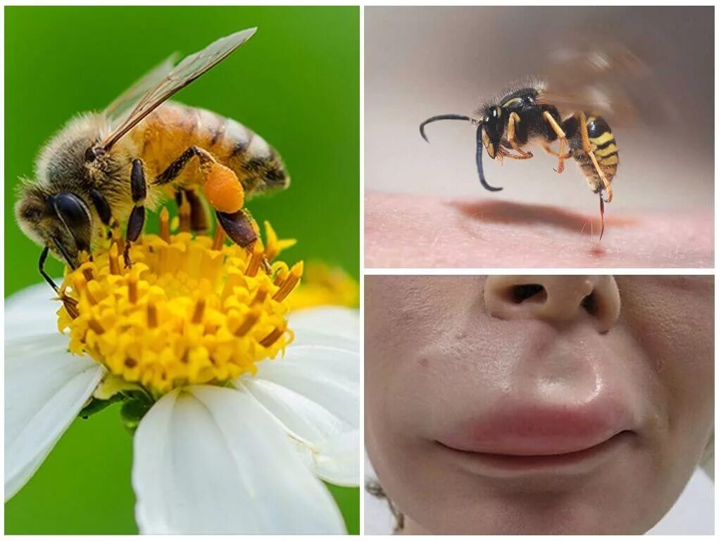 Шмель пчела Оса Шершень укусы. Шмель Оса пчела отличия укусов.