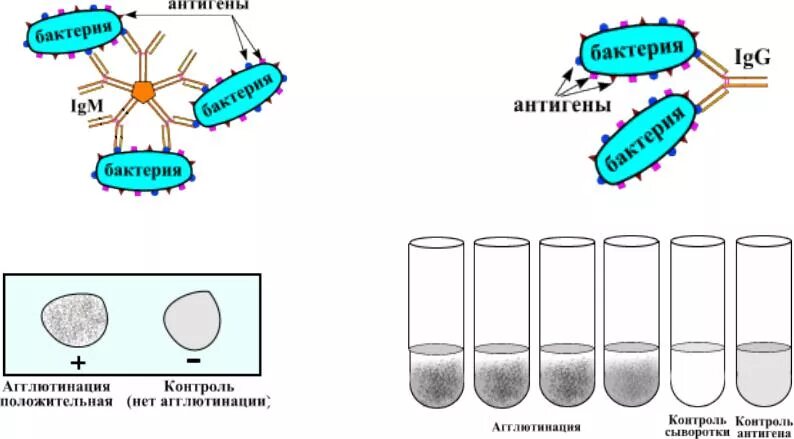 Реакция агглютинации антиген. Реакция агглютинации микробиология. Ориентировочная реакция агглютинации схема. Развернутая реакция агглютинации микробиология. Реакция агглютинации схема микробиология.