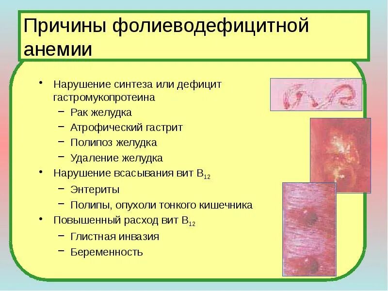 Симптомы фолиеводефицитной анемии. Осложнения фолиеводефицитной анемии. Фолиеводефицитная анемия причины. В12 фолиеводефицитная анемия. Атрофический вагинит мкб