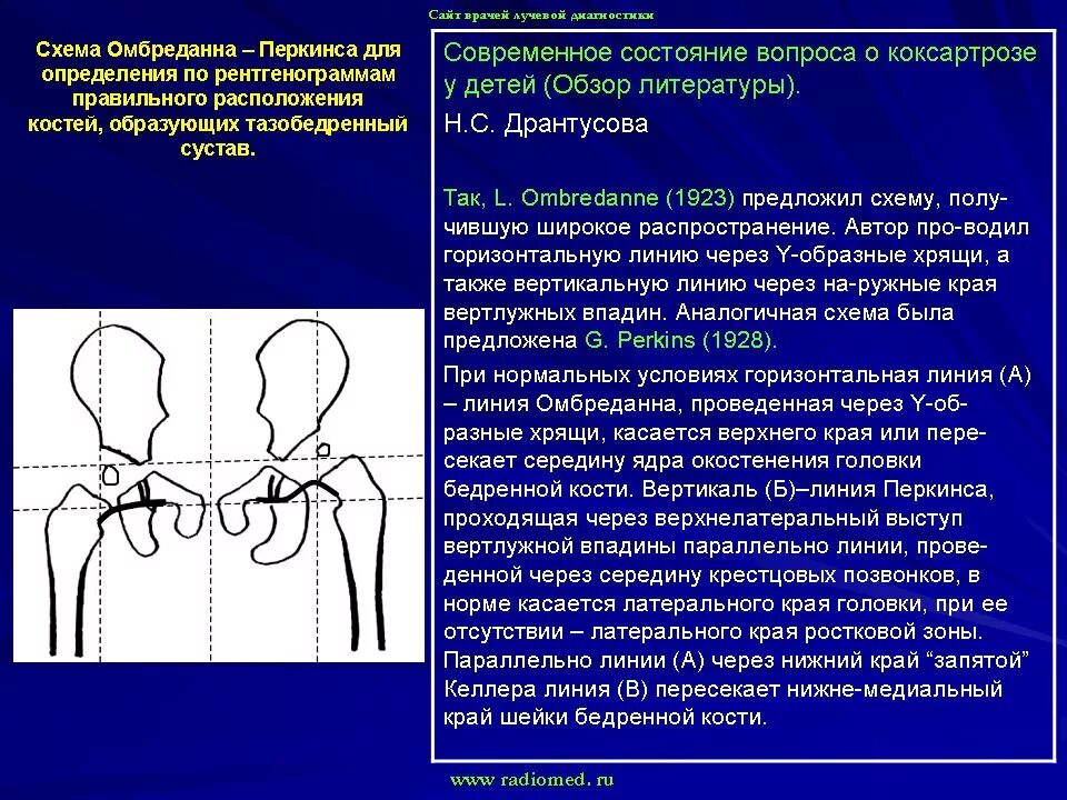 Угол шарпа