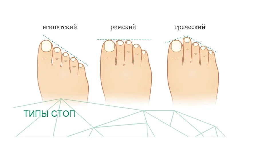 Типы стопы. Типы пальцев на ногах. Типы строения пальцев ног. Типы форм пальцев на ногах. 3 типа стопы