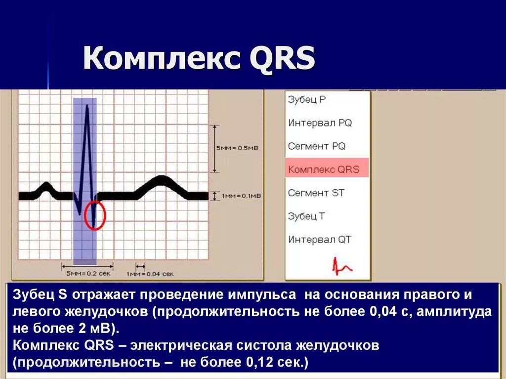 ЭКГ комплекс QRS В v2. Комплекс зубцов QRS на ЭКГ. Зубцов QRS на ЭКГ отображает. Комплекс QRST на ЭКГ отражает.