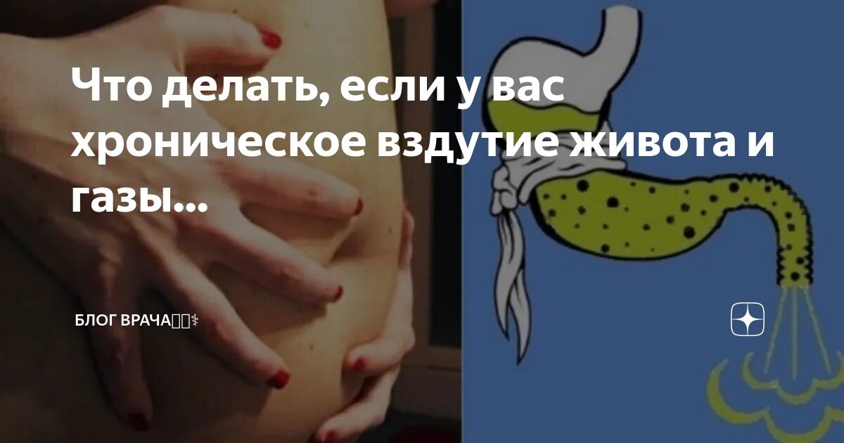 Кишечник вздутие лечение у женщин причины. Живот при вздутии кишечника. Хроническое вздутие живота.