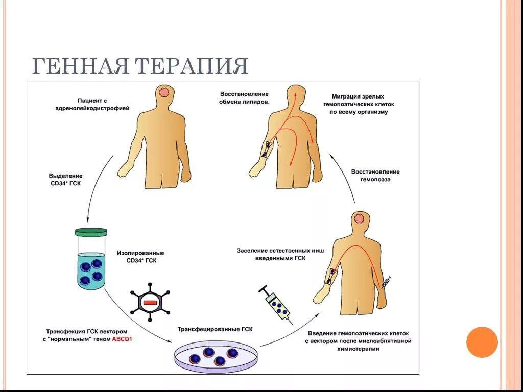 Генная терапия заболеваний. Схема проведения генной терапии. Последовательность генной терапии схема. Генная терапия in vivo ex vivo. Схемы генной терапии in vivo и ex vivo.