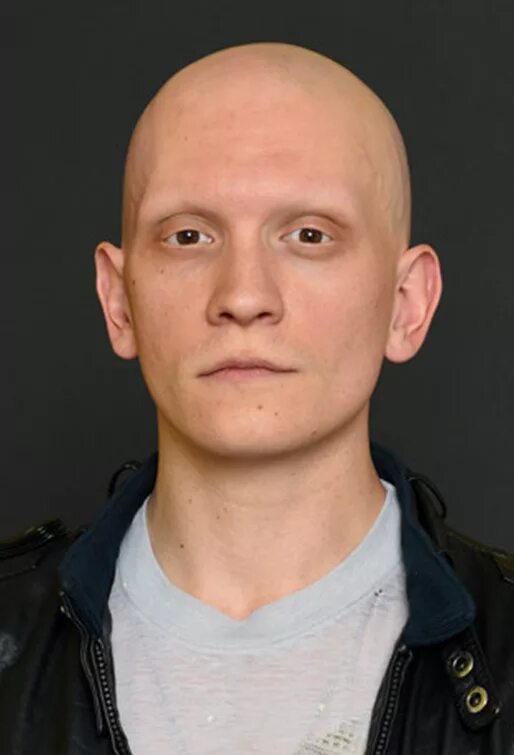 энтони кэрриган готэм. энтони кэрриган. энтони кэрриган до болезни. энтони кэрриган готэм. энтони карригана.