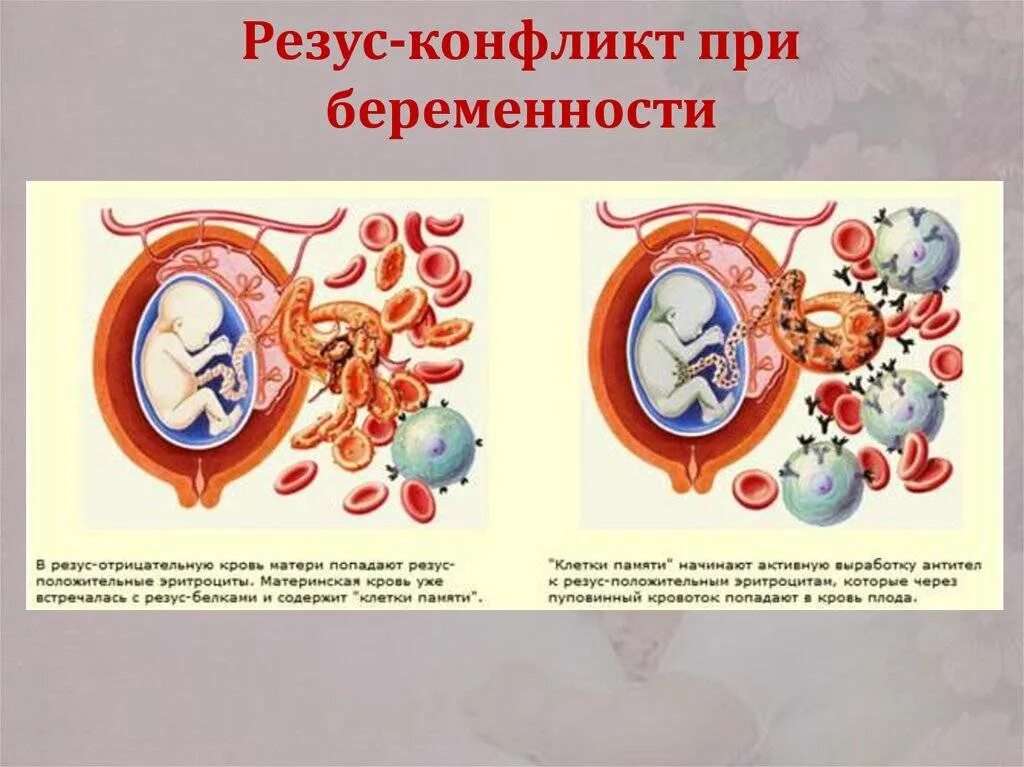 Резус-конфликт при беременности препараты. Резус-конфликт при беременности матери и плода. Клинические проявления резус конфликта. Резус конфликт схема. После резус конфликта