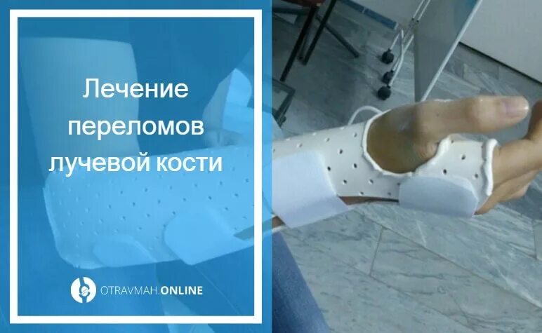Отзывы после перелома лучевой кости. Перелом лучевой кости гипс. гипс при переломе лучевой кости со смещением. перелом лучевой кости без смещения гипс. гипс после перелома лучевой кости.