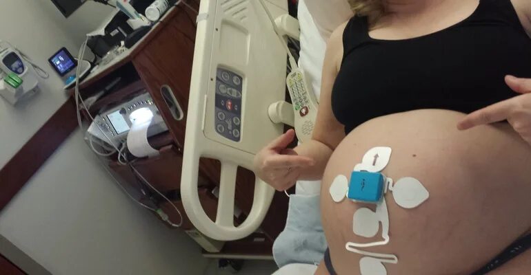 Через сколько родили после прокола