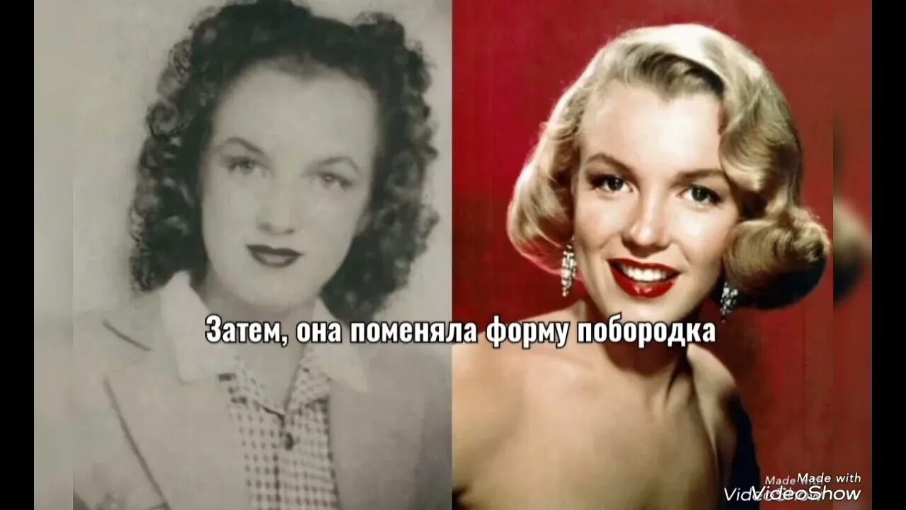 Мэрилин монро до пластики. Операции монро. Мерлин монро до пластики. Мерлин монро пластическая операция. Операции монро.