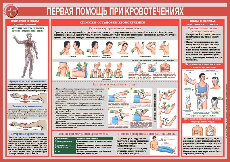 Первая помощь при кровотечениях. Плакаты по оказанию первой помощи. Памятка оказание первой помощи при кровотечениях. Первая медицинская помощь при кровотечениях.