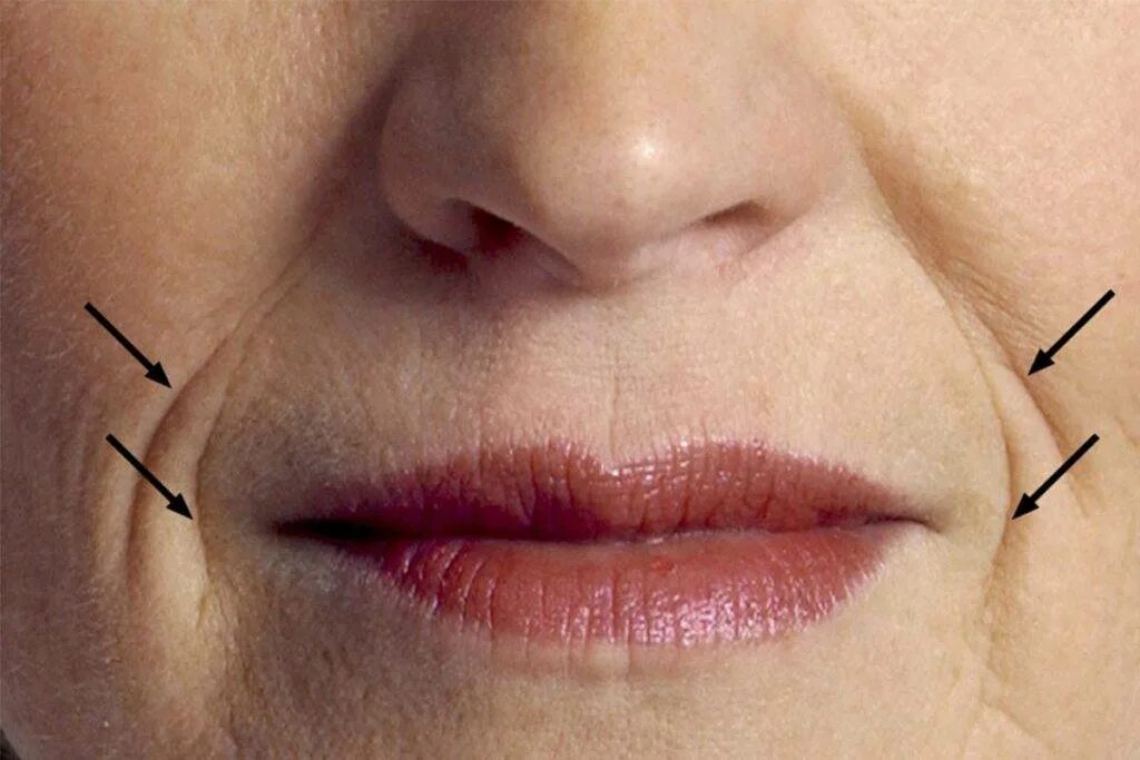 Под уголками губ. Под уголками губ. Под уголками губ. Фото обычных губ. Губы человека фото.