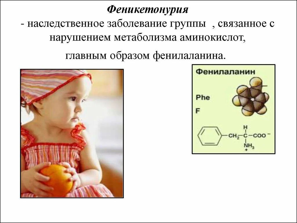 Фенилкетонурия фермент. Наследственные нарушения аминокислот. Наследственные и врожденные заболевания. Нарушение белкового обмена заболевания. Нарушение обмена аминокислот.