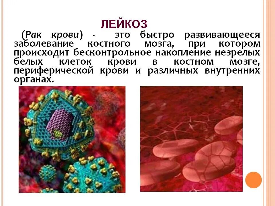 Leikoz. Лейкозы. Опухолевые заболевания крови. Заболевание крови лейкоз.