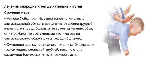 Хрип у малыша