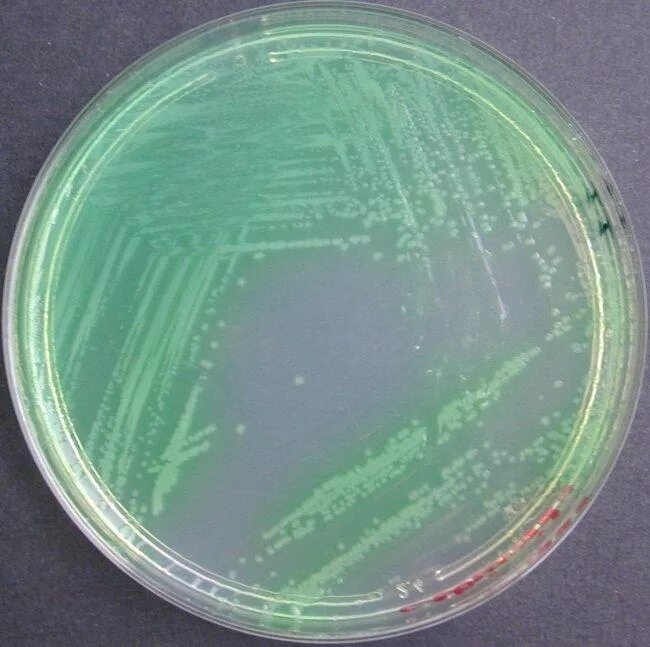 Бактерии в жидкой среде. Малахитовый агар синегнойная палочка. Pseudomonas aeruginosa на чашке Петри. Синегнойная палочка в чашке Петри. Pseudomonas aeruginosa колонии.