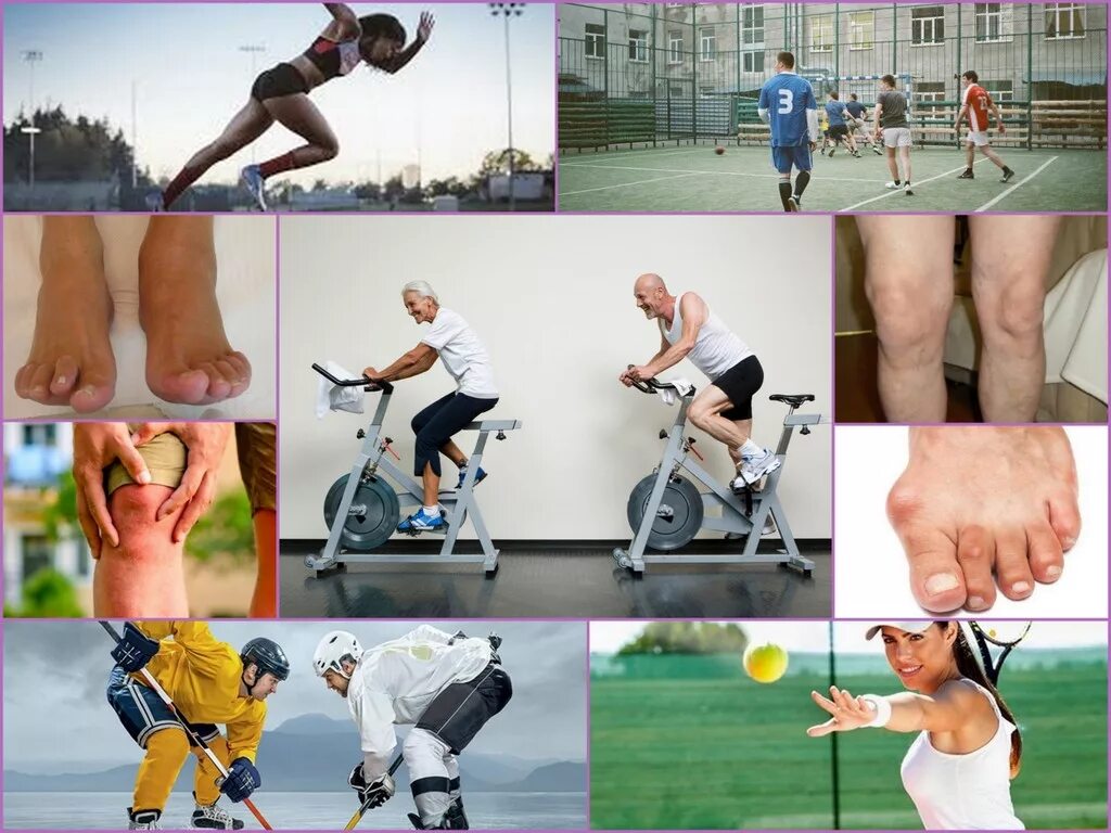 При артрозе суставов больше двигаться или лежать. Спорт при артрозе коленного сустава. Артроз и спорт. Спорт занятия при артрозе. Упражнения в тренажерном зале при артрозе коленного сустава.