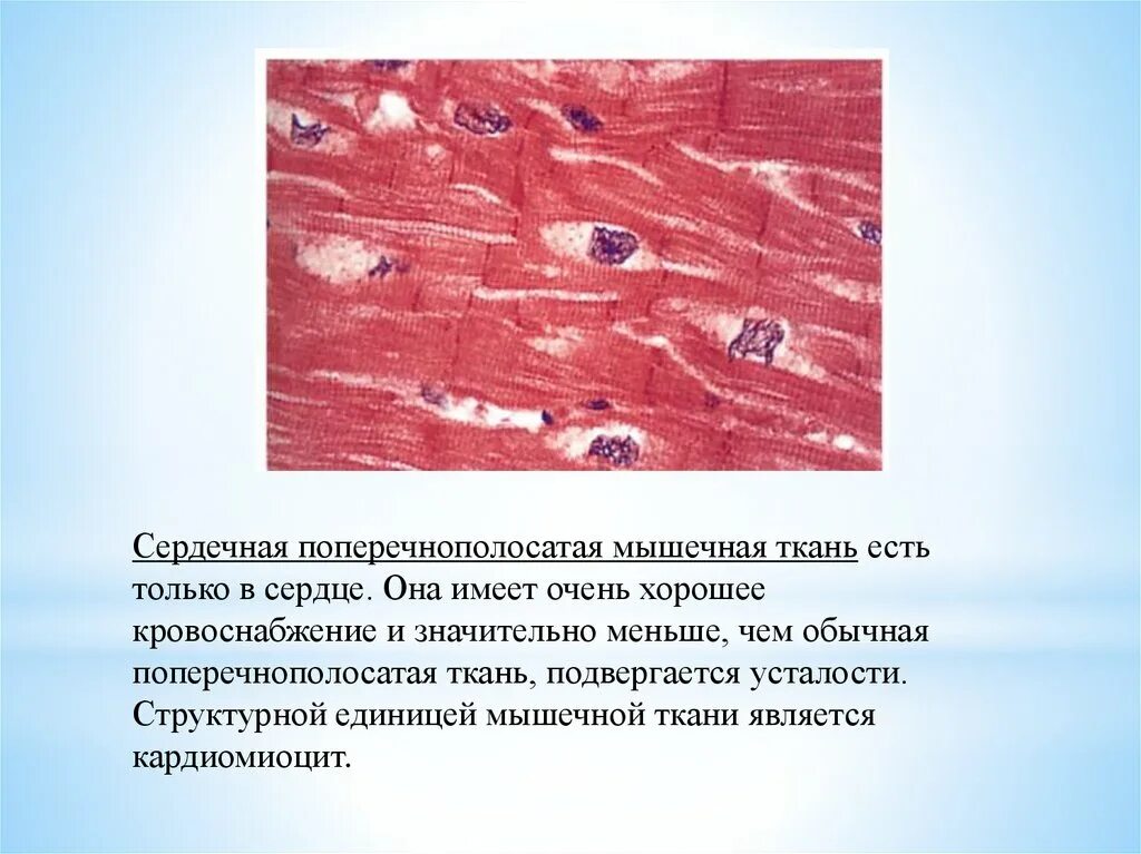 Сердечная мышечная ткань рисунок. Поперечнополосатая сердечная мышечная ткань. Поперечно полосатая сердечная ткань гистология. Поперечно-полосатая сердечная мышечная ткань гистология. Клетки поперечно-полосатой сердечной мышечной ткани.