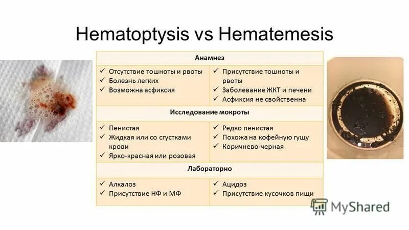 Пенистая мокрота заболевания