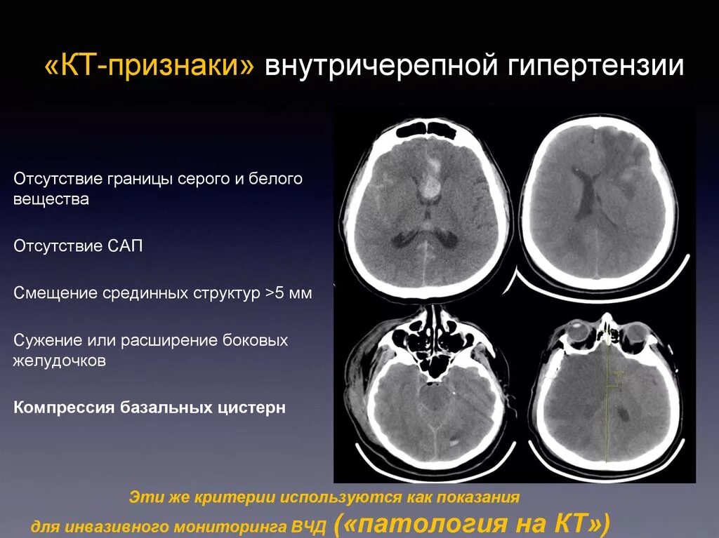 Симптомы кт
