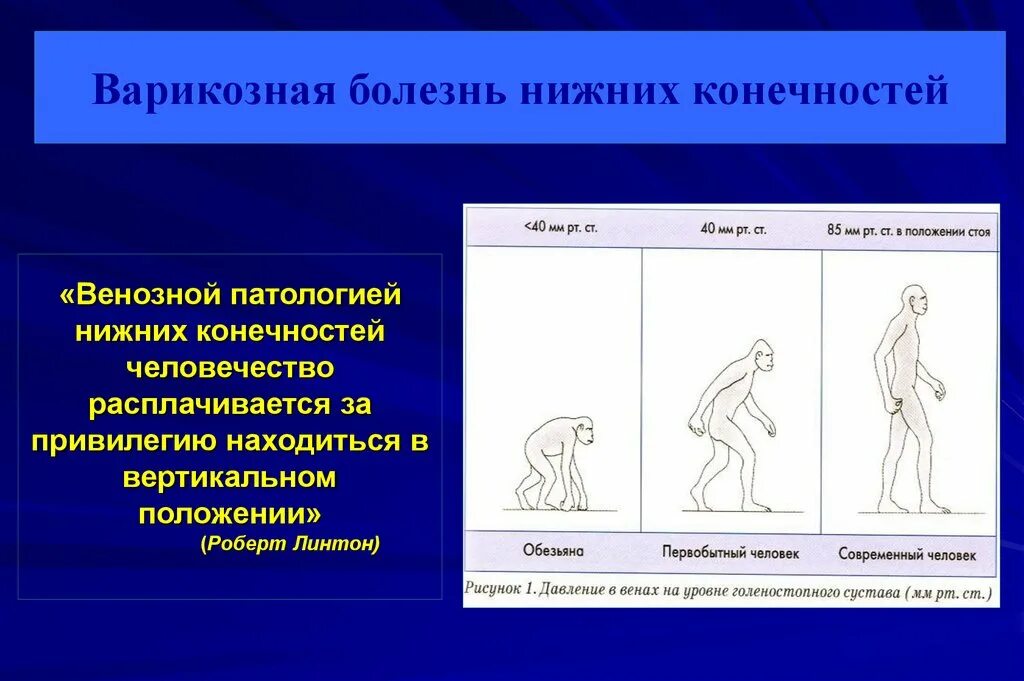 Варикозная болезнь вен нижних конечностей код мкб. Варикозное расширение вен мкб 10. Варикозная болезнь нижних конечностей. Варикозхная болезньнижних конечностей. Код заболевания варикозное расширение вен нижних конечностей.