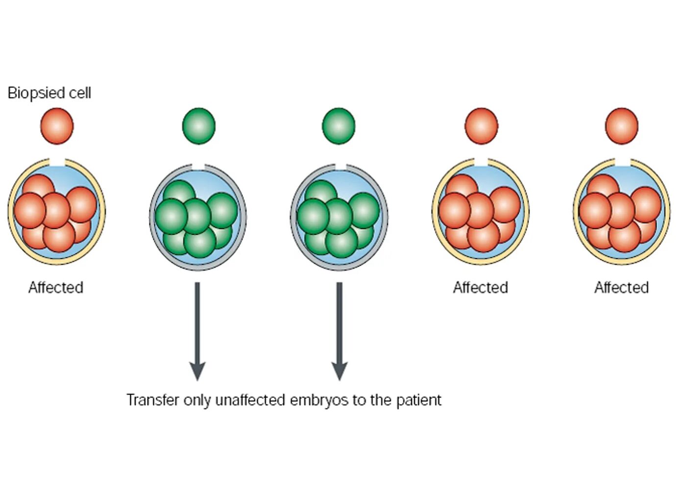 Cell effect. Preimplantation genetic diagnosis. PGD. Эмбрио тест генетико. Genetic  Testing and Screening Test.