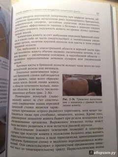 Методика драпкина